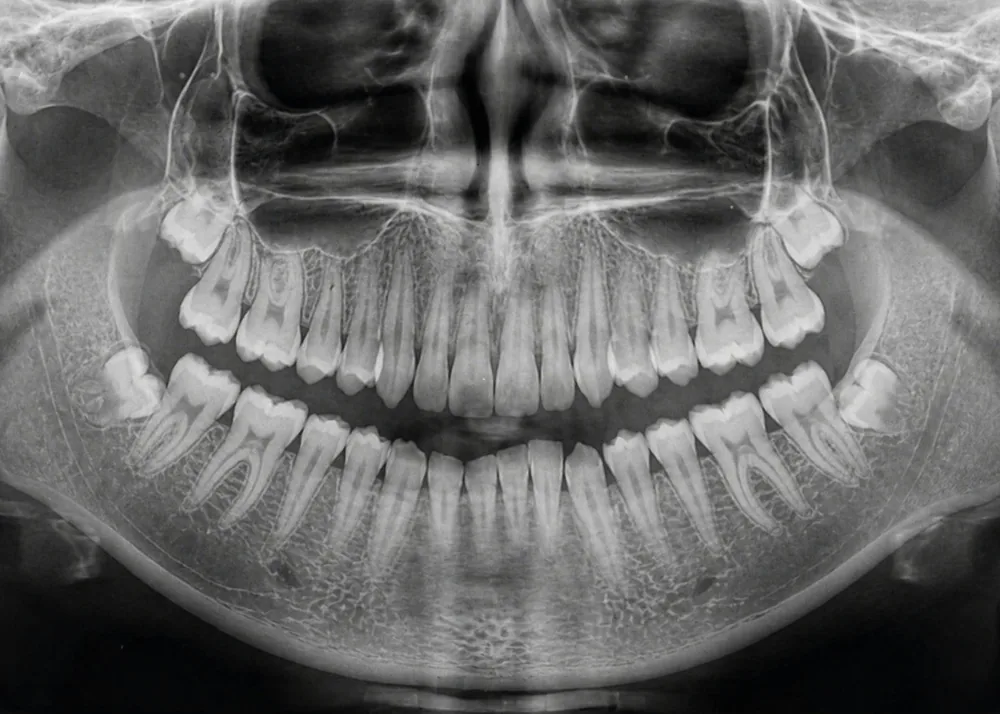 Radiografía panorámica dental